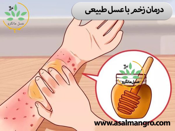 درمان زخم با عسل طبیعی